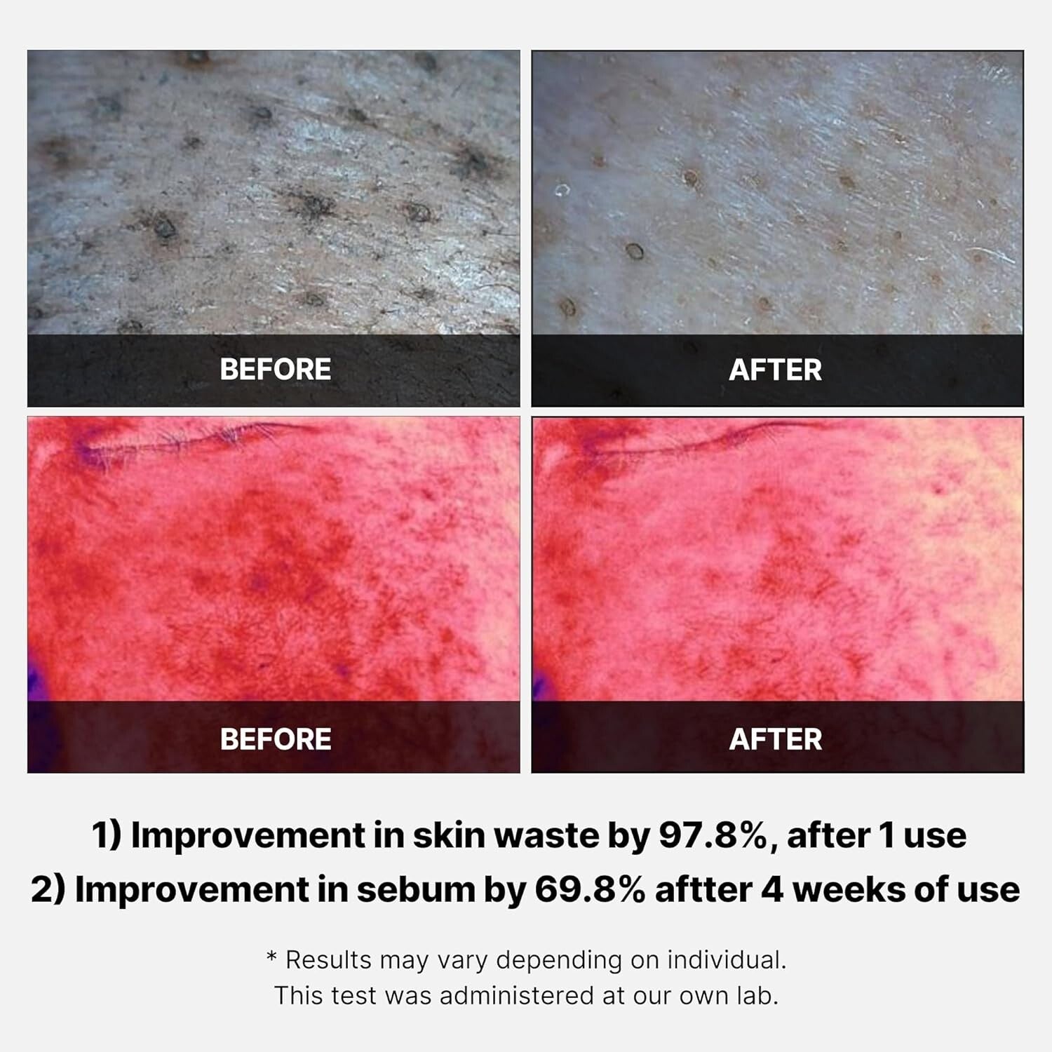 Medicube Red Succinic Acid Peeling Pad | Red Succinic Acid Panthenol Pads